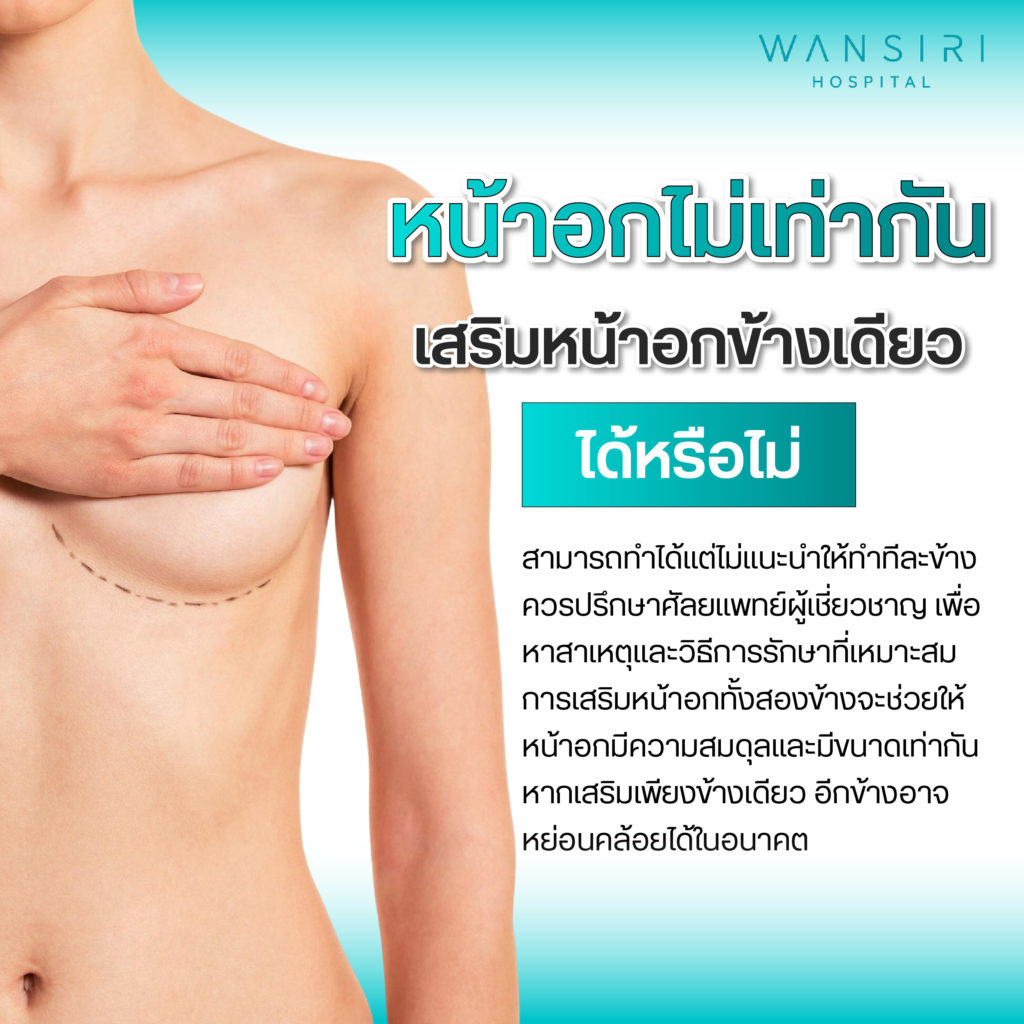 หน้าอกไม่เท่ากัน เสริมหน้าอกข้างเดี่ยวได้ไหม